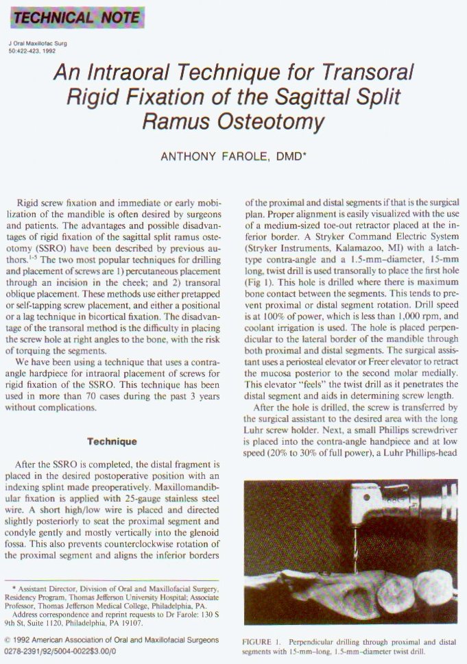 An-Intraoral-Technique-for-Transoral-Rigid-Fixation-of-the-Sagittal-Split-Ramus-Osteotomy