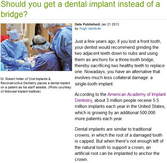 Dental Implant