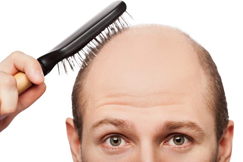 Philadelphia Hair Transplant Debunking These Common Hair Loss Myths