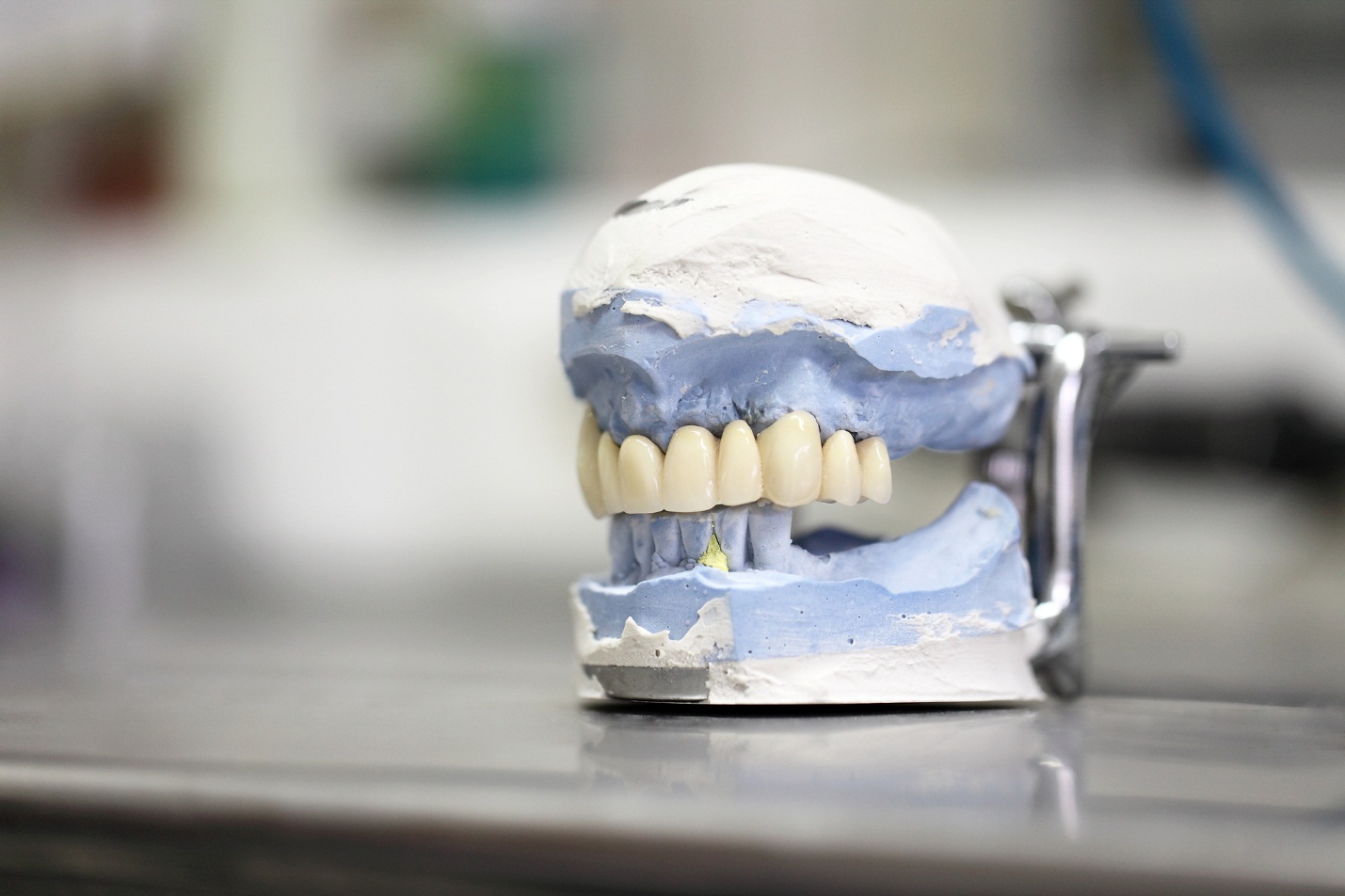 Dental Implants Bala Cynwyd