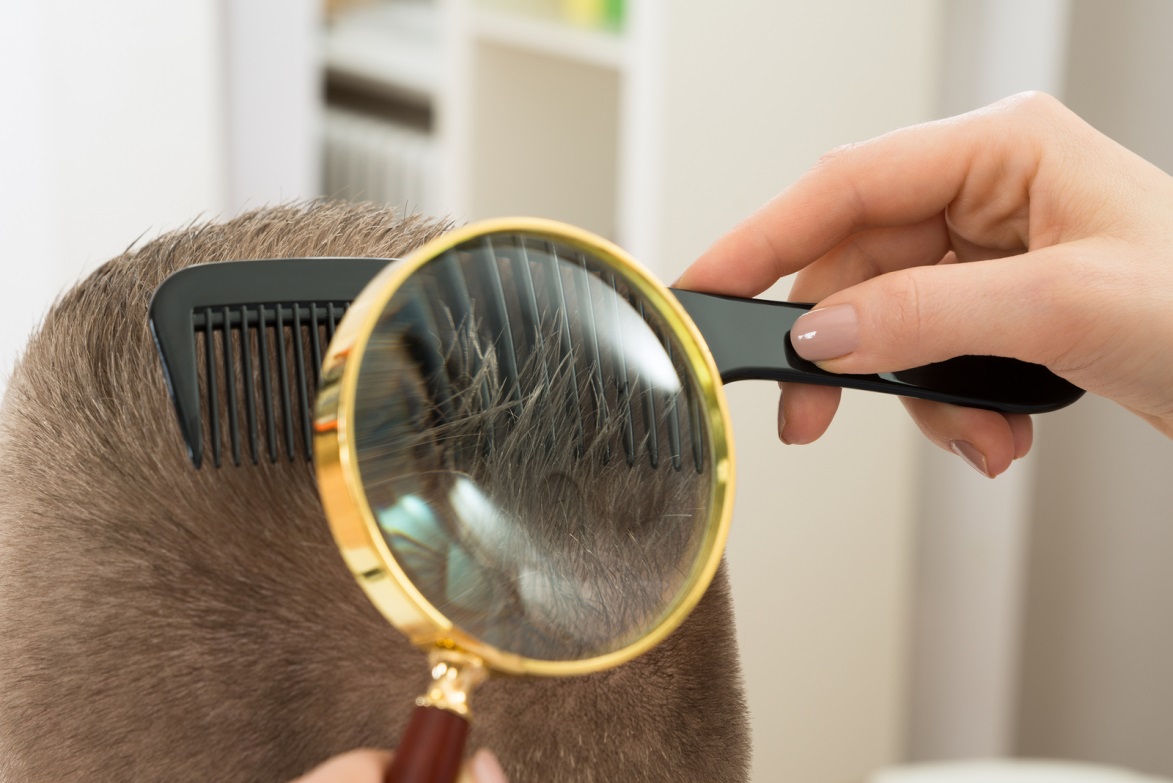 Hair Restoration Bala Cynwyd, PA