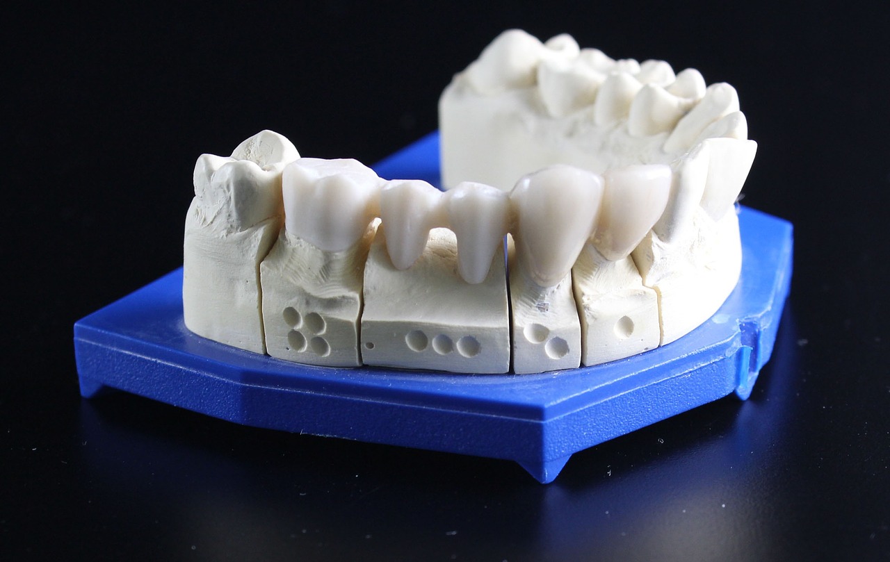 Bruxism Bala Cynwyd