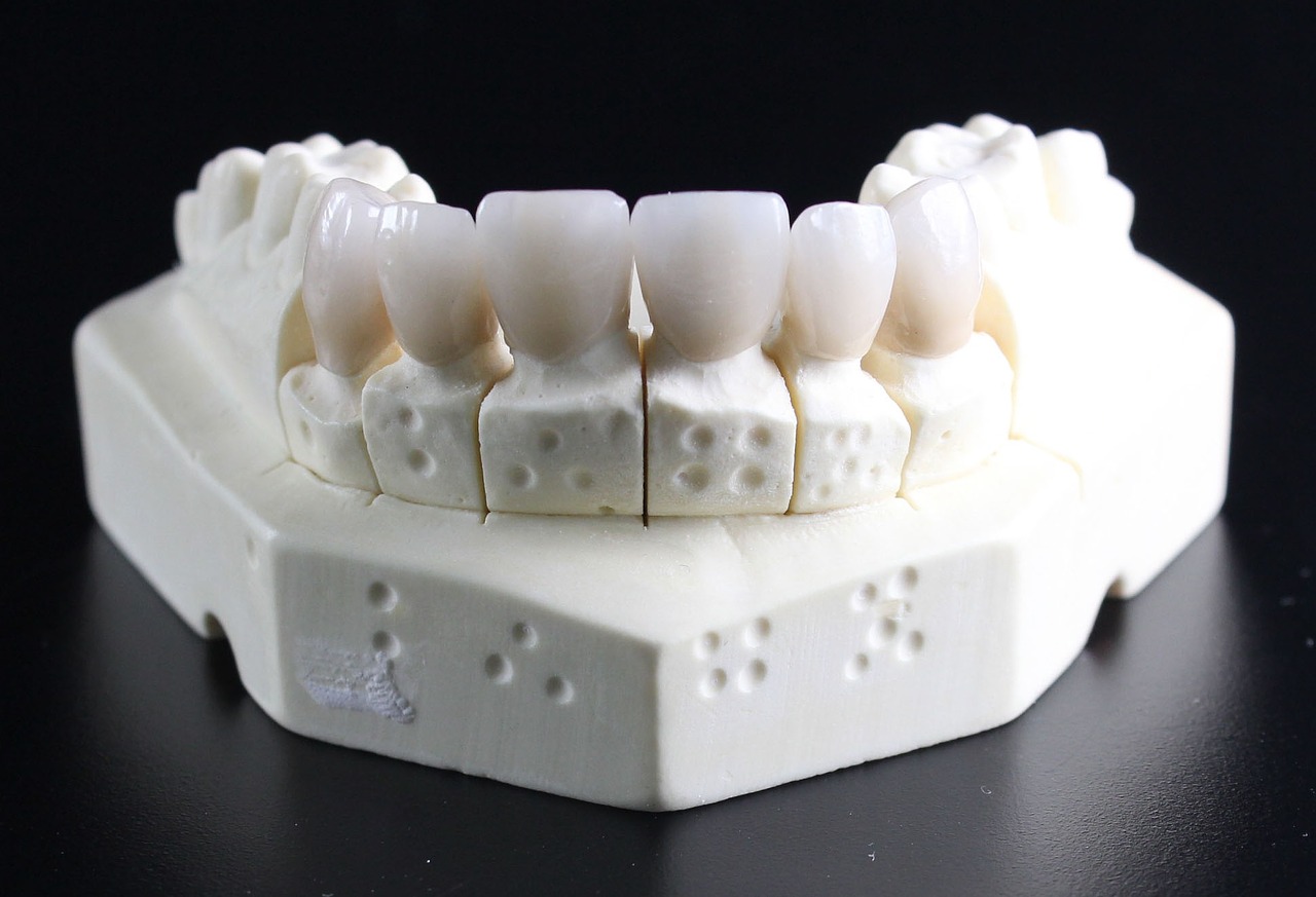 Tooth Replacement Bala Cynwyd