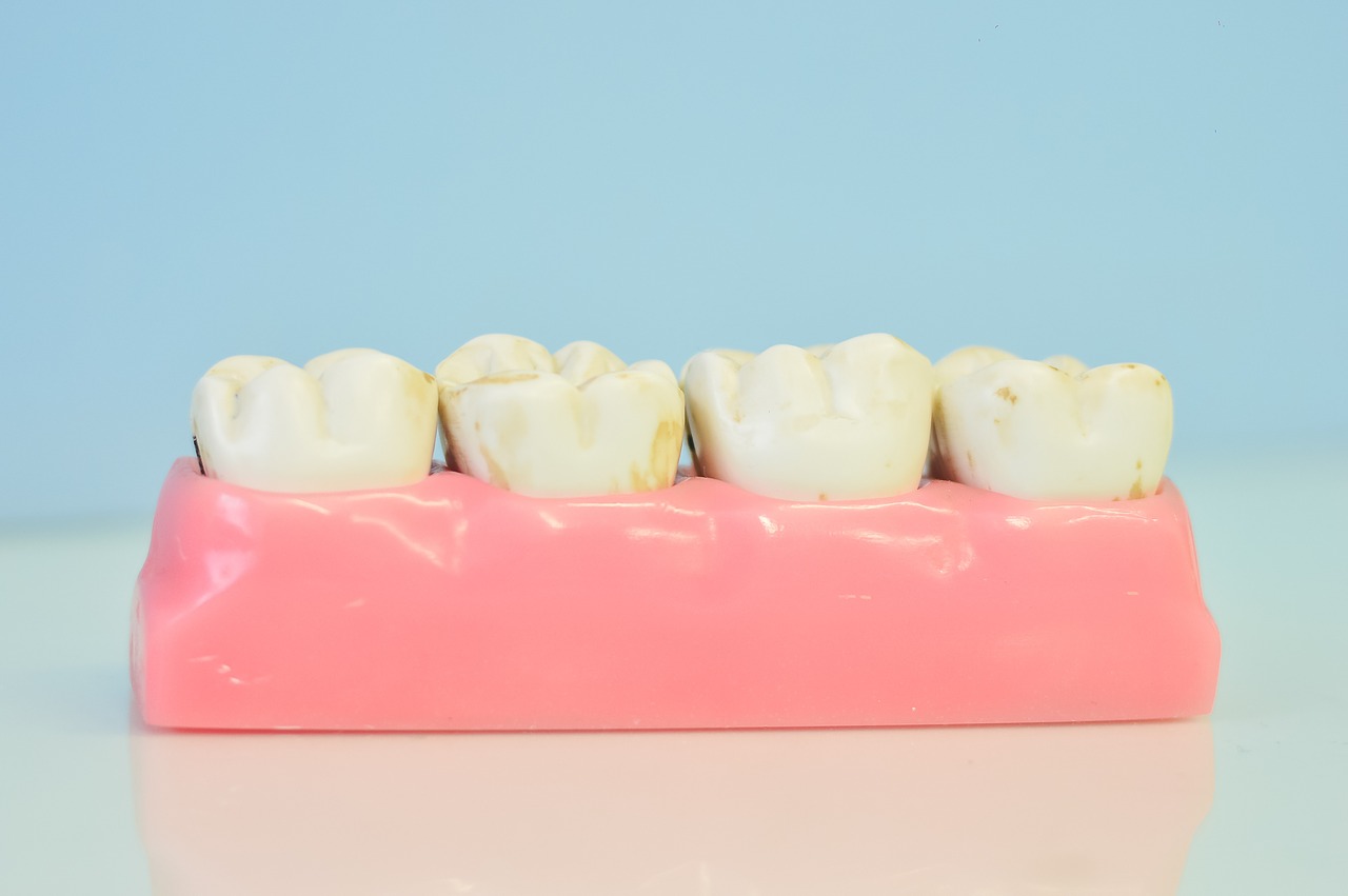 Dental Implants Bala Cynwyd, PA