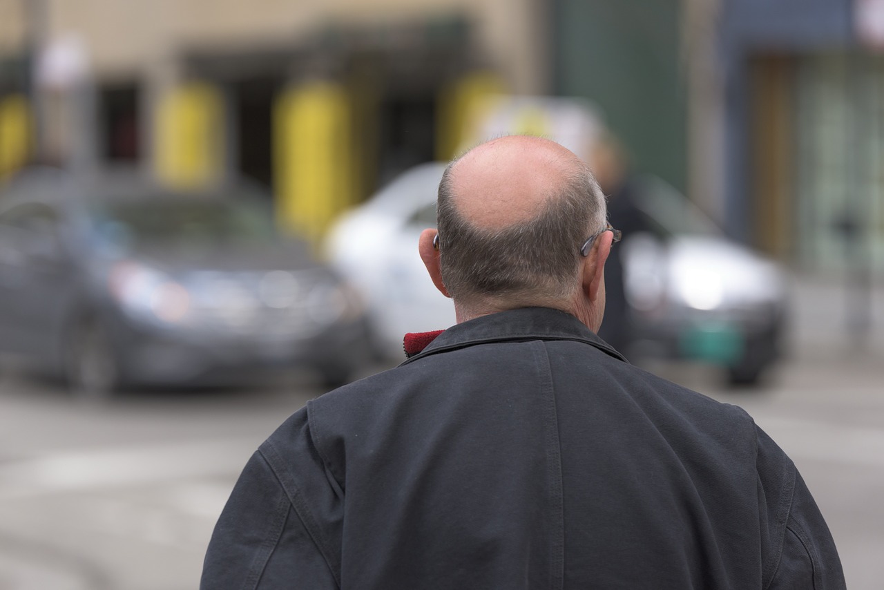 Hair Transplant Bala Cynwyd, PA