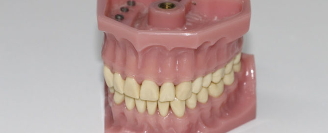 Gums Recession