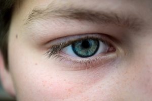 Eyebrow Hair Restoration Bala Cynwyd