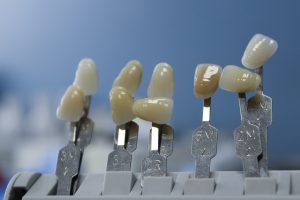 Dental Implant Sizes Bala Cynwyd