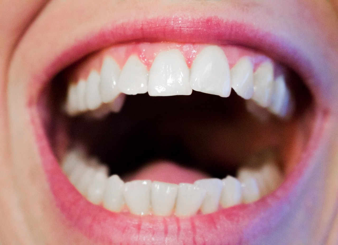 Dental Implants Bala Cynwyd