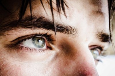Eyelid Surgery Bala Cynwyd