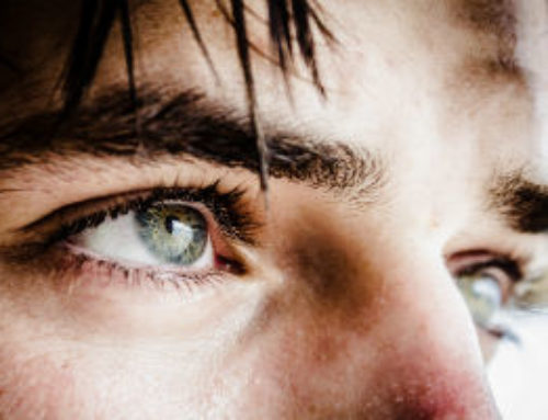 Do I Need Eyelid Surgery?