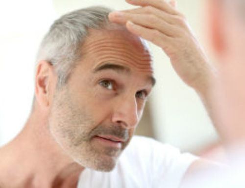 How Long Does Hair Restoration Last?