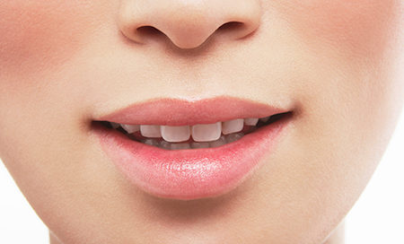 Dermal Fillers Bala Cynwyd