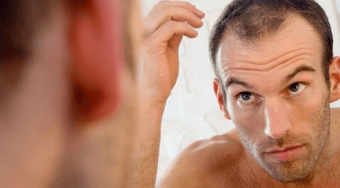 Hair Transplant Bala Cynwyd