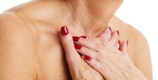Neck Lift Chemical Peel
