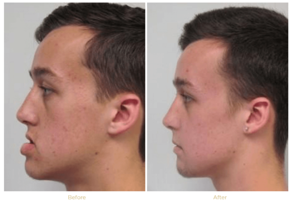 Reconstructive & Orthognathic Surgery Bala Cynwyd