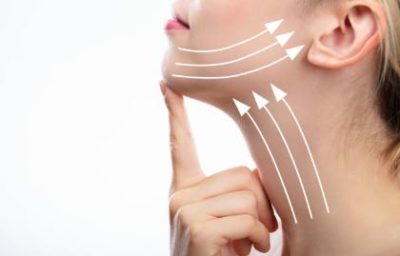 Bala Cynwyd Neck Lift