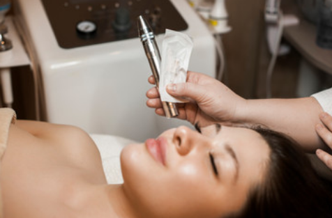 Bala Cynwyd RF Microneedling