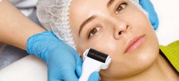 Microneedling Bala Cynwyd