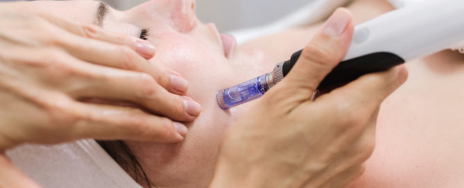 Microneedling-Bala-Cynwyd
