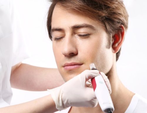 How Many RF Microneedling Treatments Are Needed?