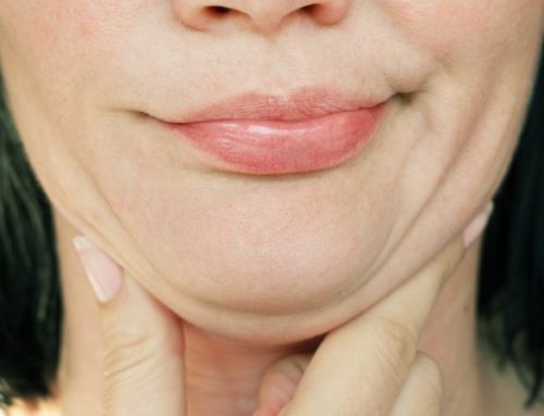 How to Lift a Saggy Neck