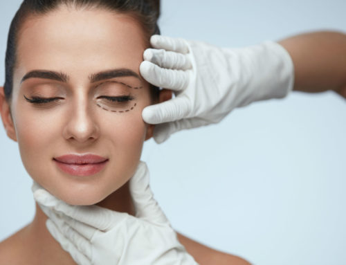 Am I a Candidate for a Blepharoplasty?