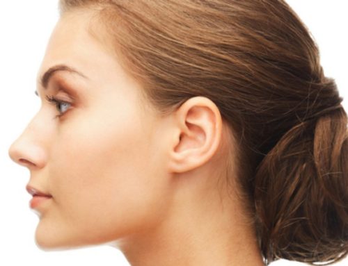What is Laser Skin Resurfacing?